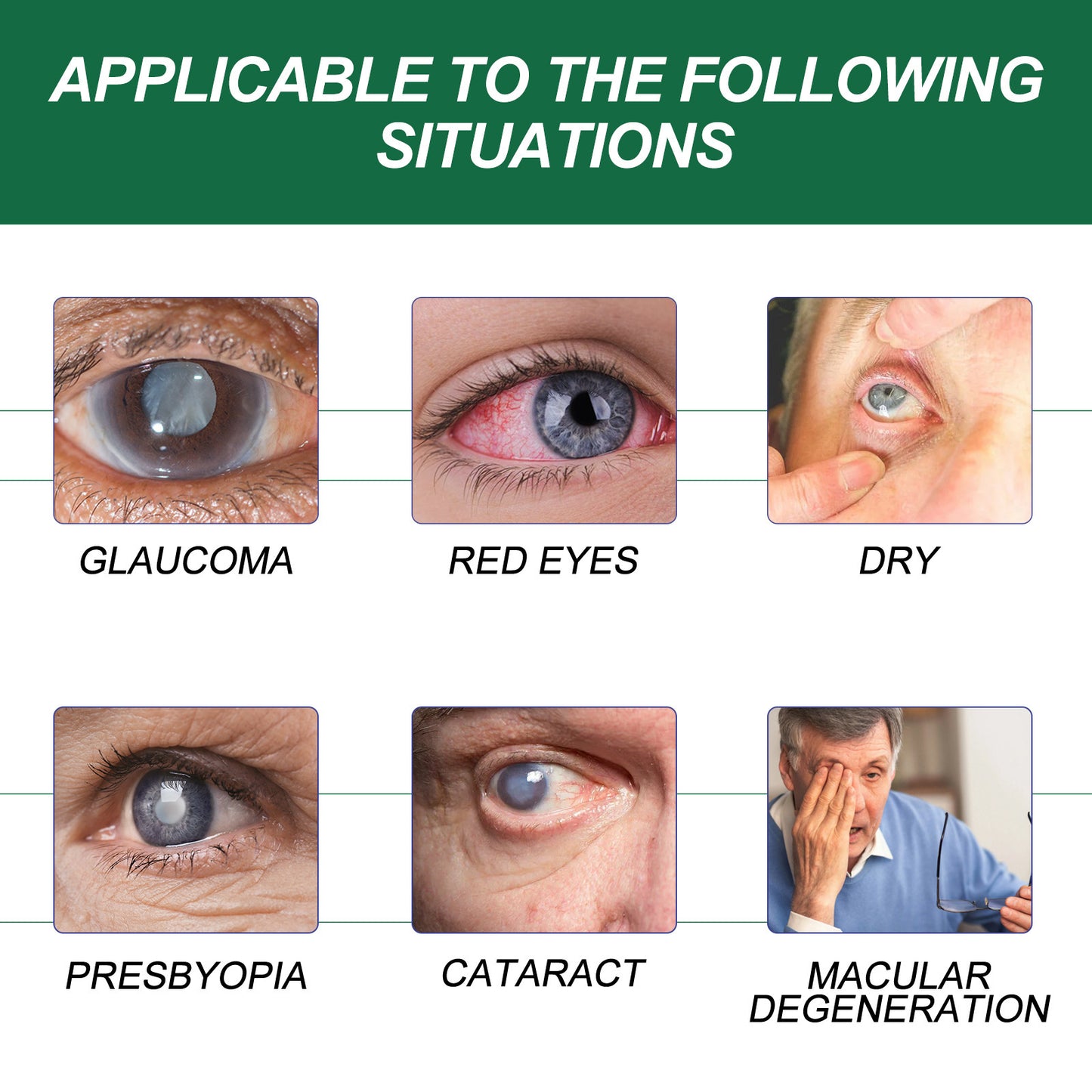 Ximonth Eye Drops Relieve Eye Fatigue, Dry Itchy Eyes, Soreness, Blurred Vision Care Solution