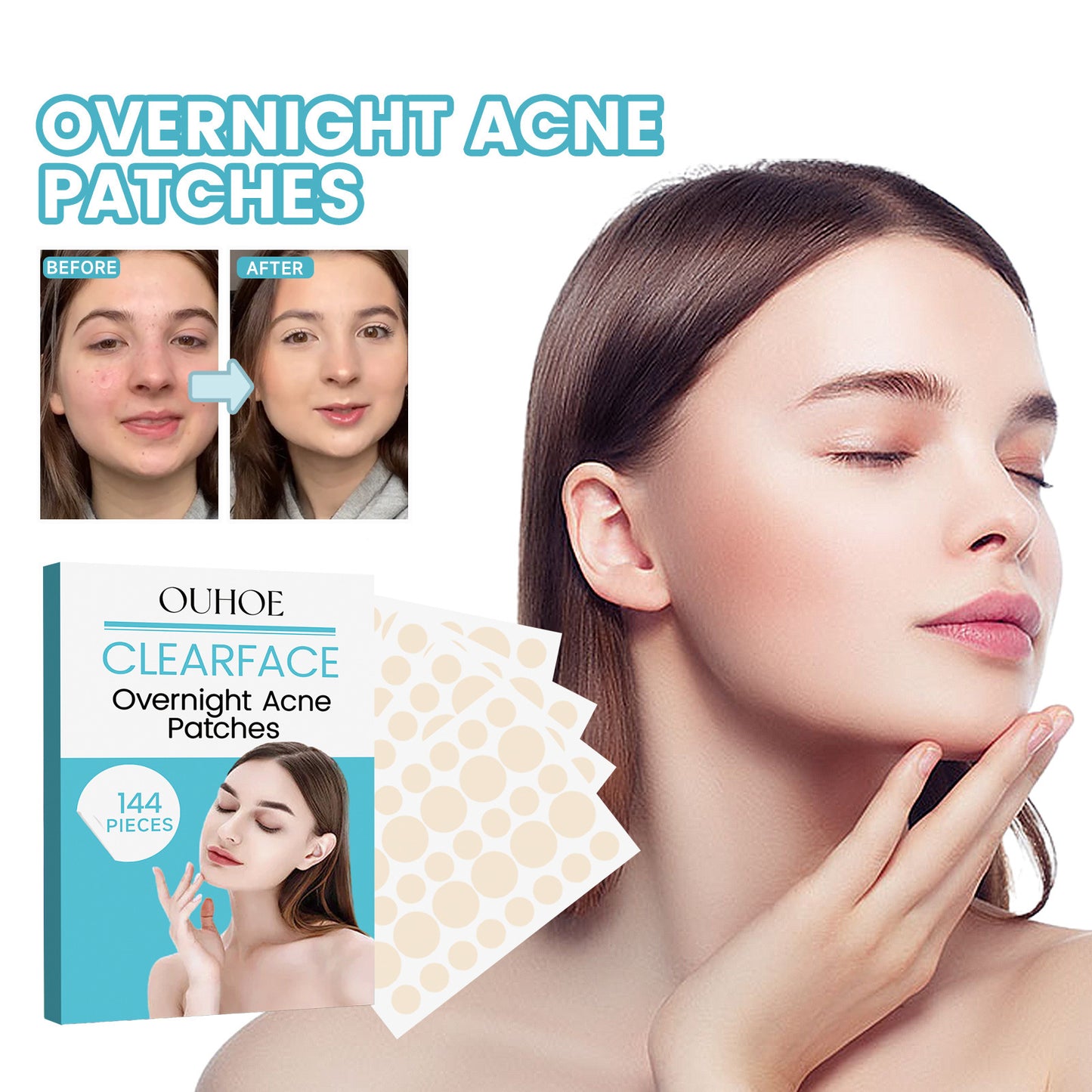 OUHOE Acne Patch သည် မျက်နှာတွင် ဝက်ခြံများကို ပျောက်ကင်းစေပြီး သက်သာပျောက်ကင်းစေပြီး concealer နှင့် လေဝင်လေထွက်ကောင်းသော ဝက်ခြံများကို ပိတ်စေသည်