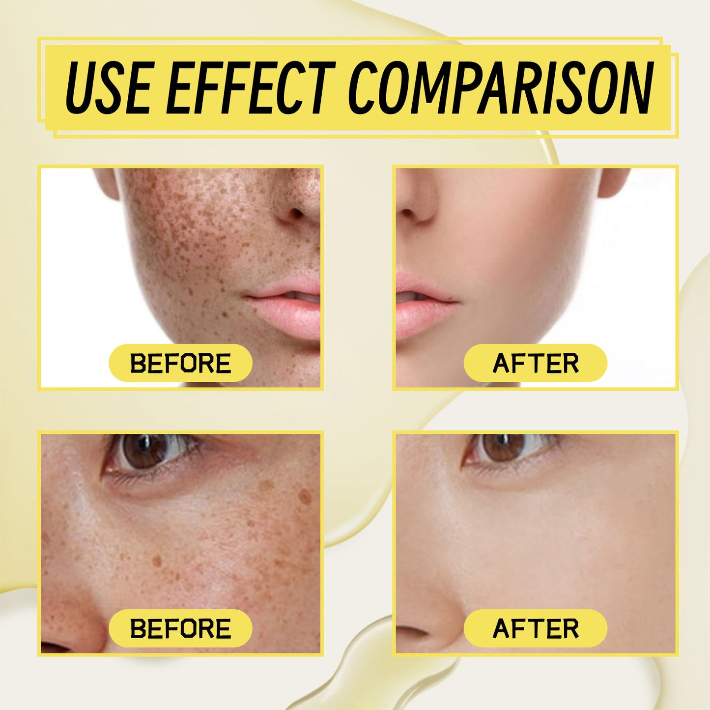 OUHOE black spot correction essence သည် မျက်နှာအစက်အပြောက်များကို ပျောက်ကင်းစေပြီး အသားအရေကို စိုပြေစေပြီး နုပျိုတောက်ပစေကာ whitening essence ၊