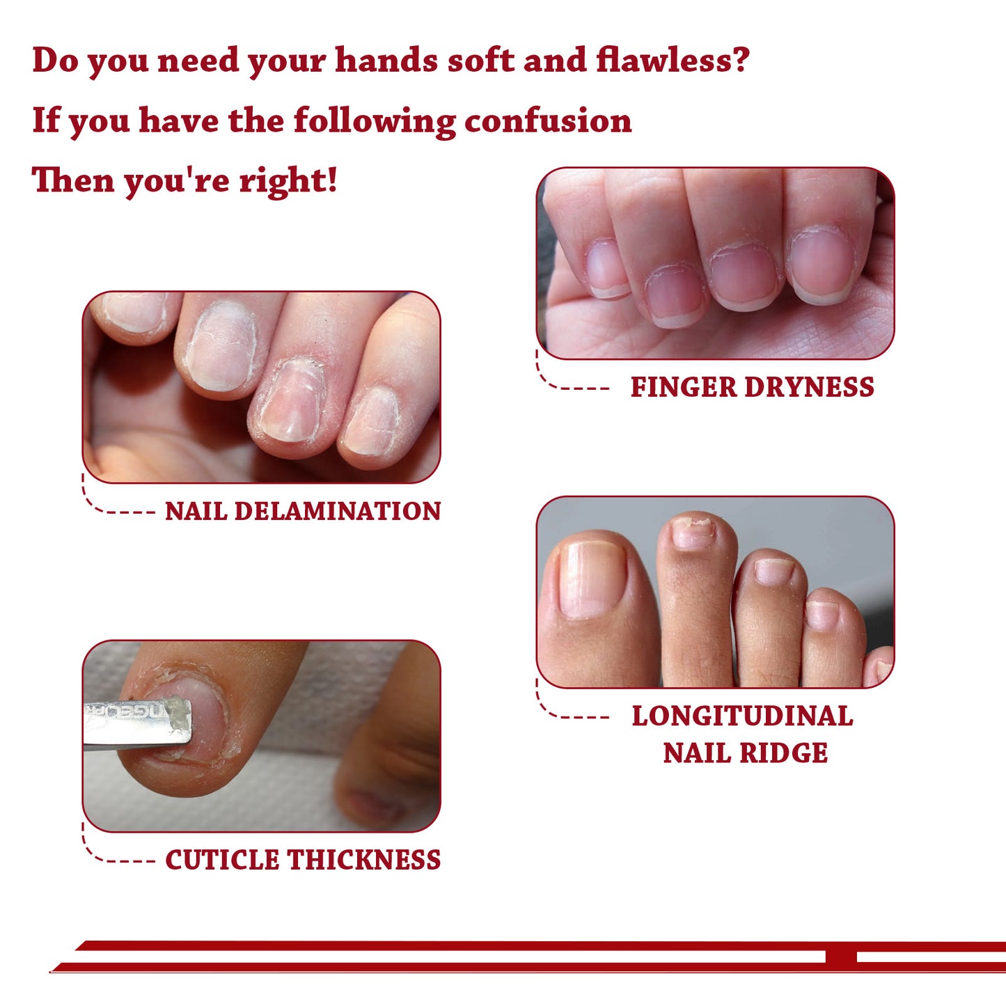 OUHOE cuticle oil strengthens nail cuticles, removes cuticles, moisturizes and nourishes nail edge armor oil