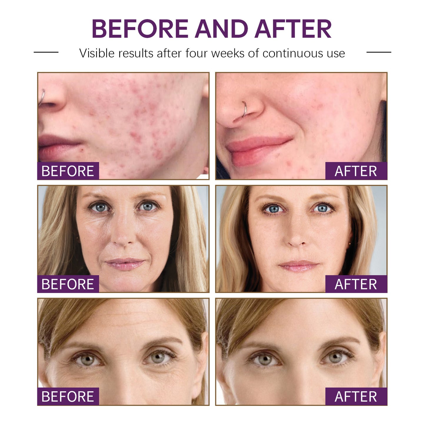 OUHOE facial moisturizing cream firming and moisturizing skin anti-wrinkle anti-aging lightening red skin skin care cream