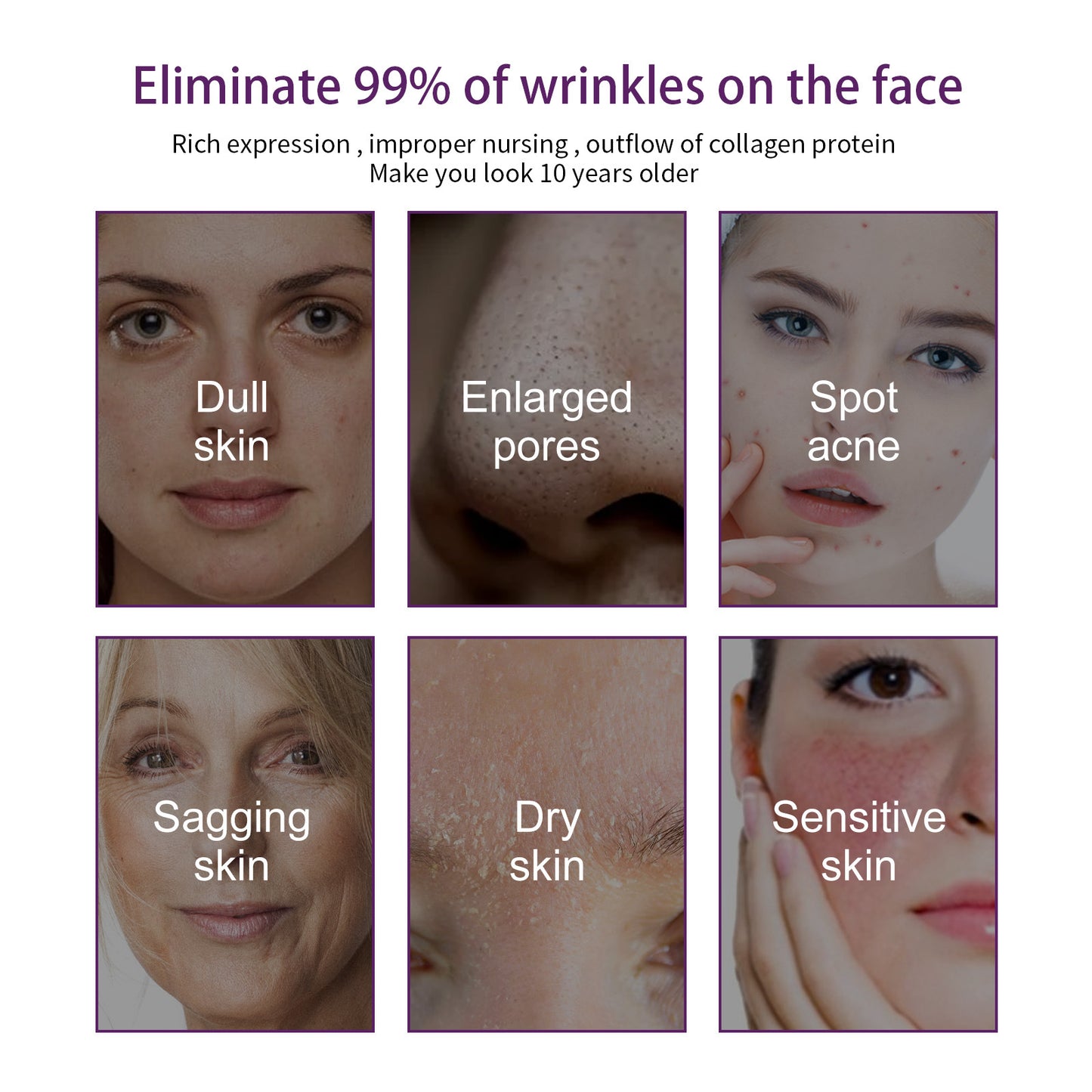 OUHOE facial moisturizing cream firming and moisturizing skin anti-wrinkle anti-aging lightening red skin skin care cream