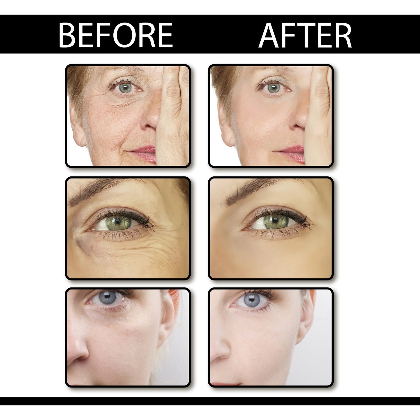 OUHOE Retinol Skin Beauty Essence, hydrating, rejuvenating, diluting dry and fine lines around the eyes, anti-dull, anti-wrinkle essence