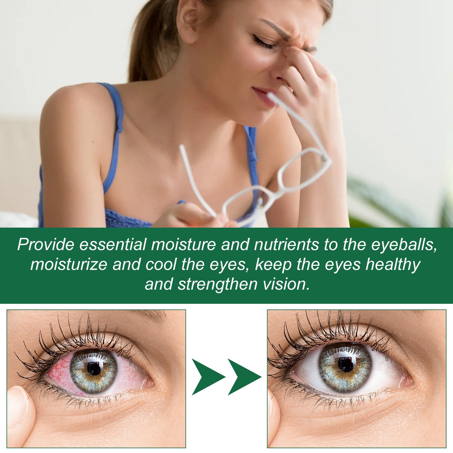 Ximonth Eye Drops Relieve Eye Fatigue, Dry Itchy Eyes, Soreness, Blurred Vision Care Solution