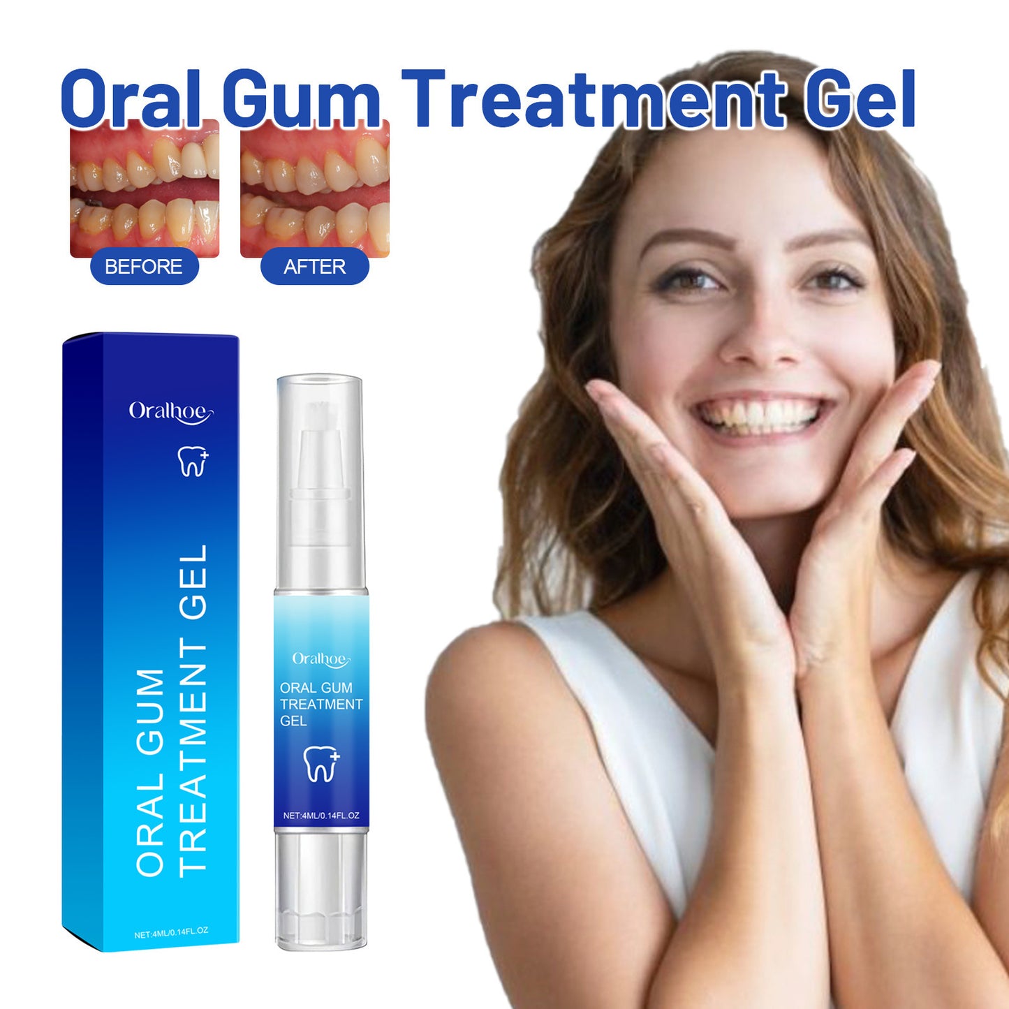 ORALHOE gum repair gel relieves gum swelling and pain, repairs and cleans stained teeth, yellow teeth, fresh breath care