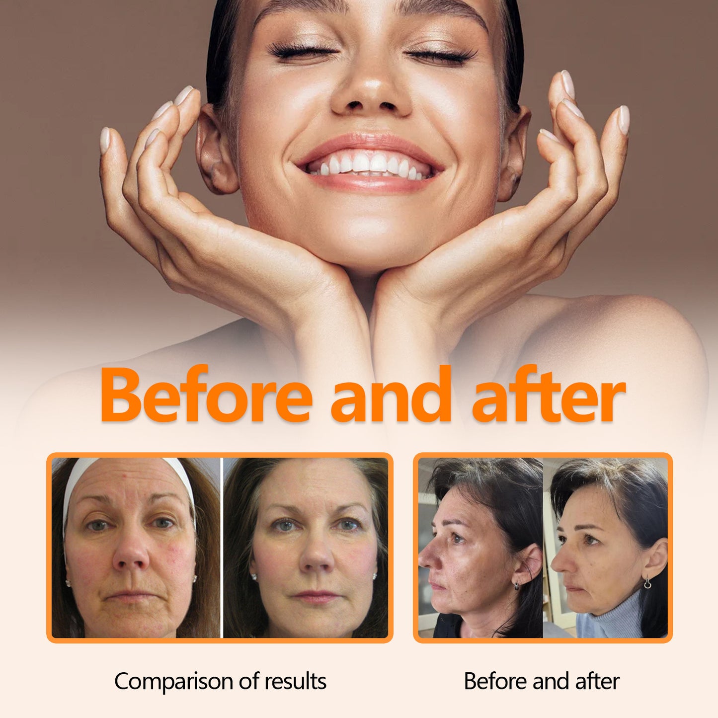 OUHOE ဗီတာမင် C Facial Essence သည် ညီညာသော အရေးကြောင်းများကို ပျောက်ကင်းစေပြီး မျက်နှာအသားရေကို တင်းရင်းစေကာ အိုမင်းရင့်ရော်မှုကို ဆန့်ကျင်ပေးသည် ။