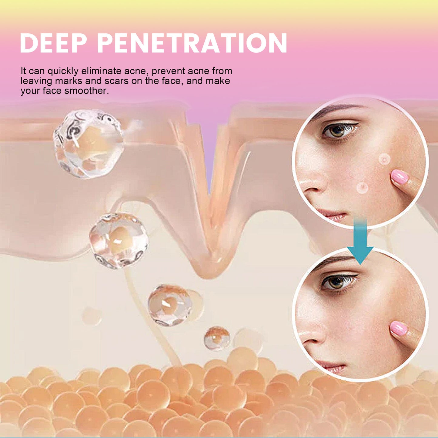 EELHOE Cute Colorful Acne Patch Cleansing Facial Acne Pimples Multi-Shape Portable Acne Patch