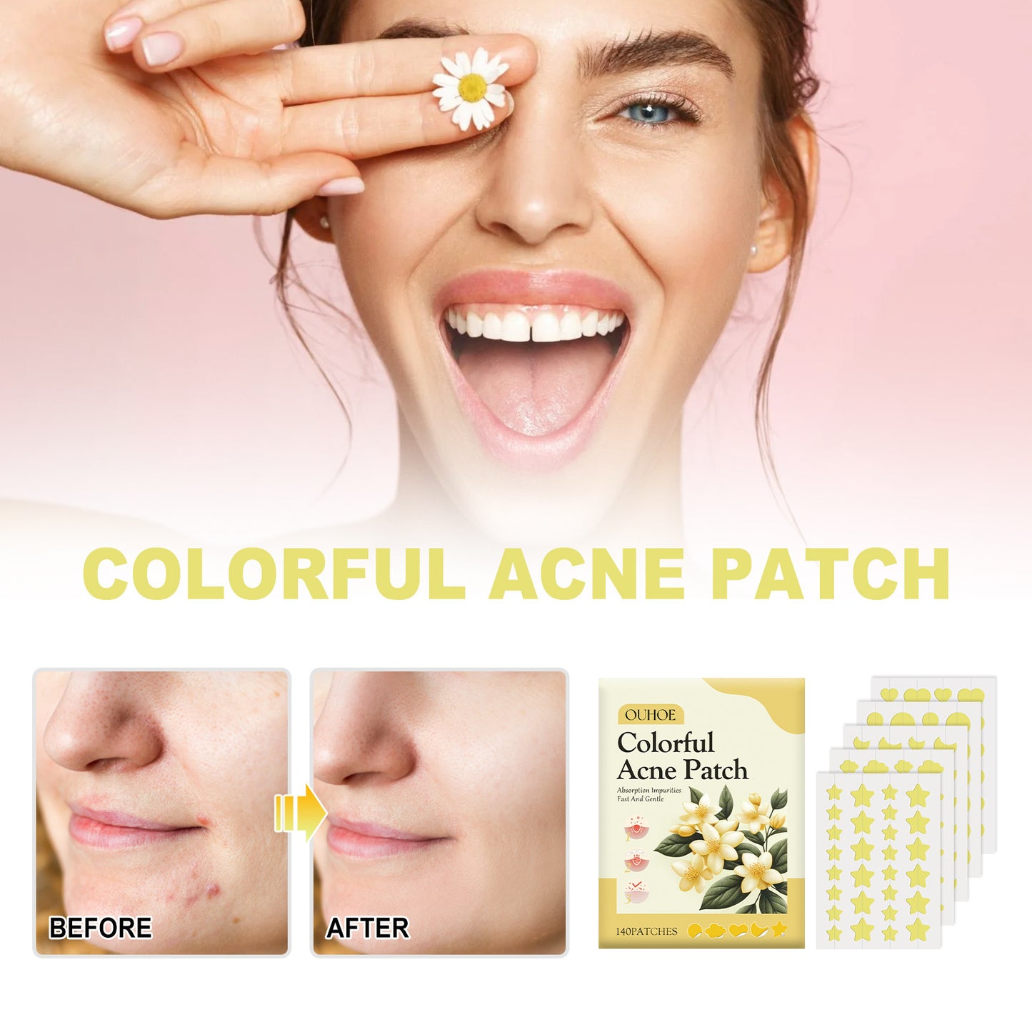 OUHOE yellow acne patch repairs facial skin, fades acne, closes mouth, smooths skin, controls oil and moisturizes