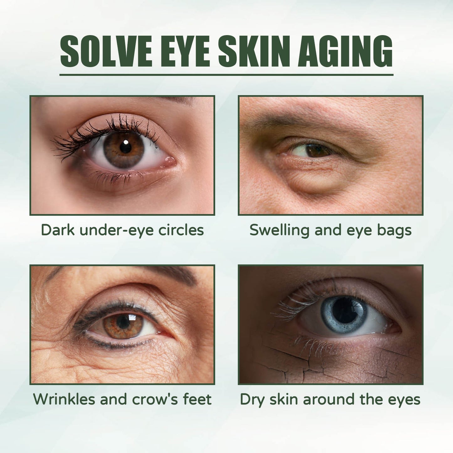 EELHOE anti-aging eye cream, firming, anti-wrinkle, multi-effect eye cream, reduces fine lines around the eyes, eye bags, dark circles, rejuvenates skin