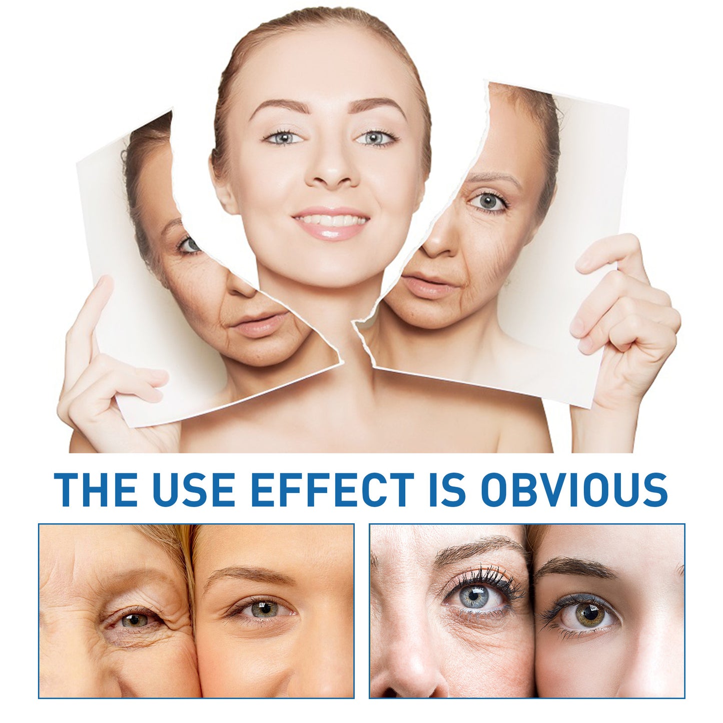 OUHOE Hyaluronic Acid Anti-Wrinkle Essence fades fine lines and wrinkles, shrinks nasolabial folds, tightens the skin, hydrates and rejuvenates the skin