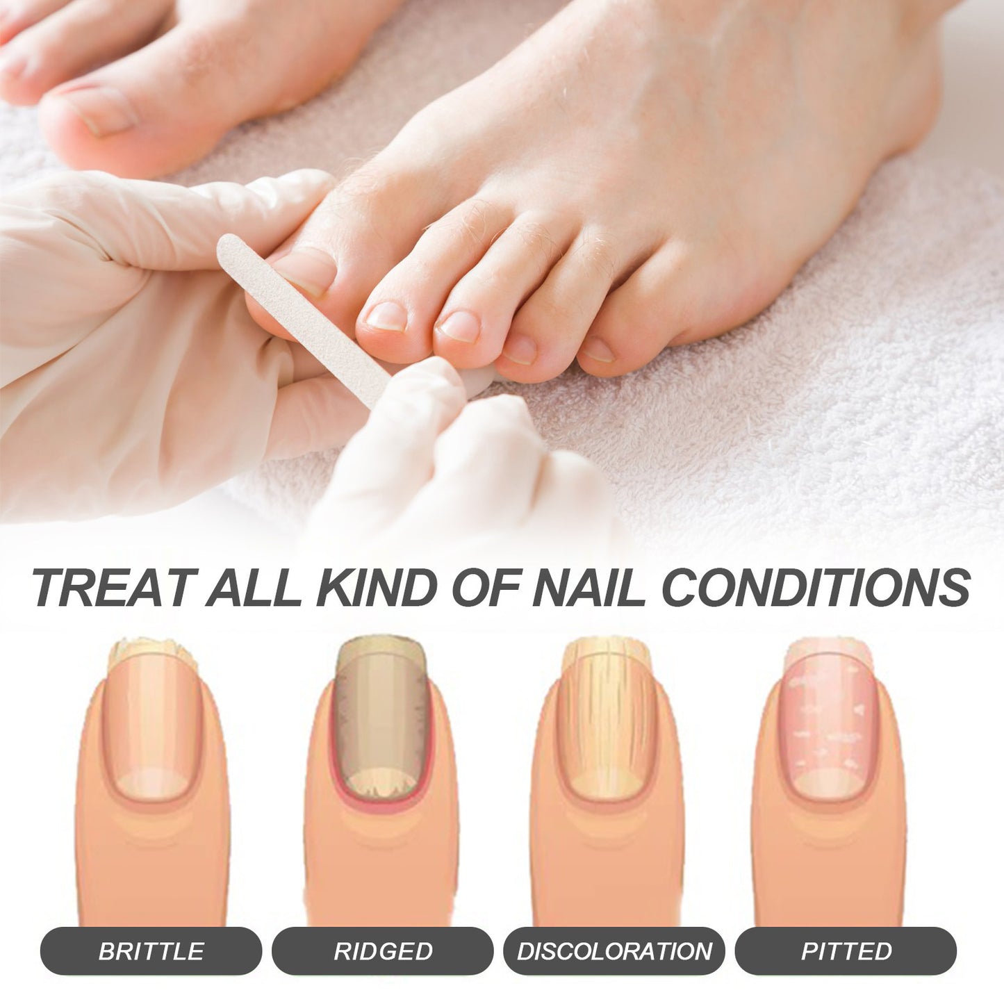 OceAura Nail Care Oil Repair Onychomycosis on Hands and Feet Soft Nails Bright Nails Thickened Jasmine Style