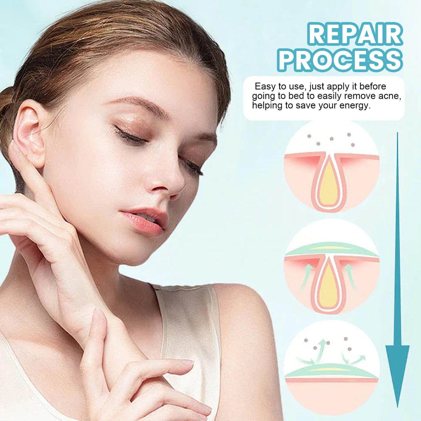 OUHOE Acne Patch သည် မျက်နှာတွင် ဝက်ခြံများကို ပျောက်ကင်းစေပြီး သက်သာပျောက်ကင်းစေပြီး concealer နှင့် လေဝင်လေထွက်ကောင်းသော ဝက်ခြံများကို ပိတ်စေသည်