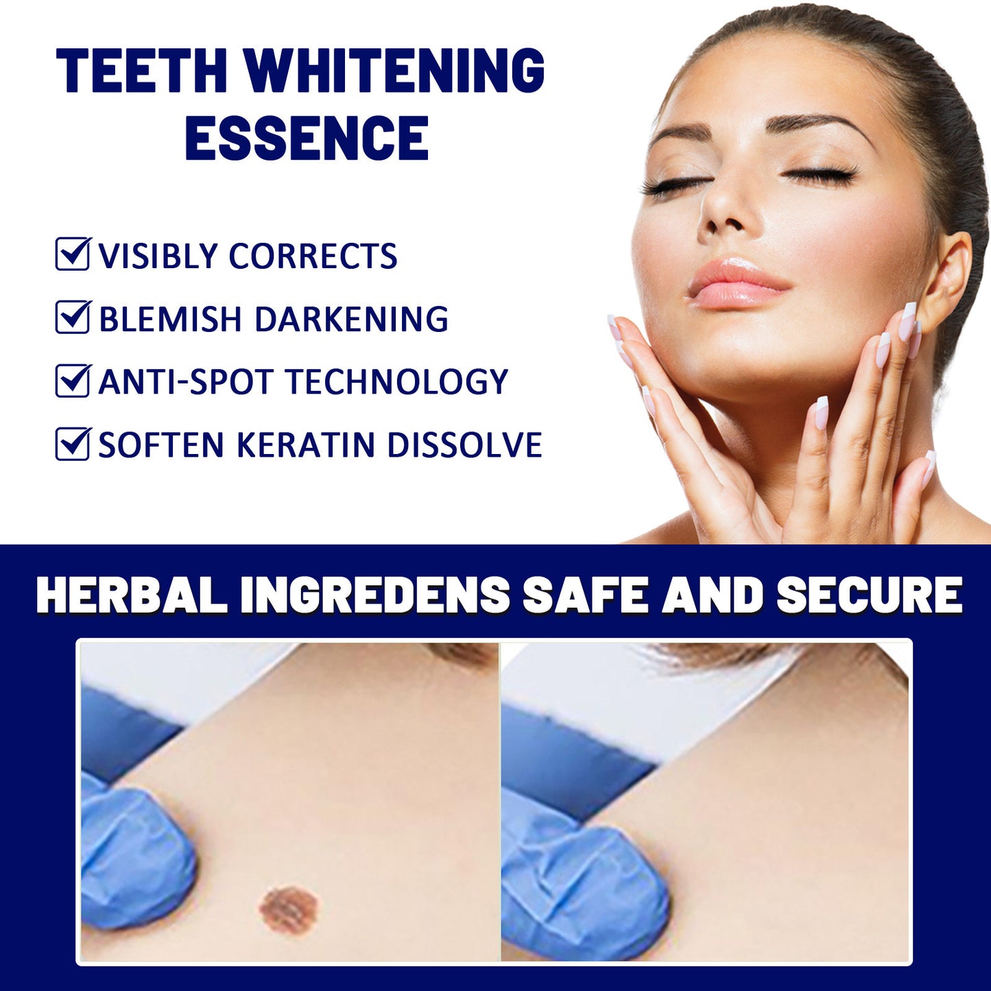 OUHOE Skin Tag Fading Cream Corns Cream Care Clean Skin Body Face Flat Uke Wart Cream