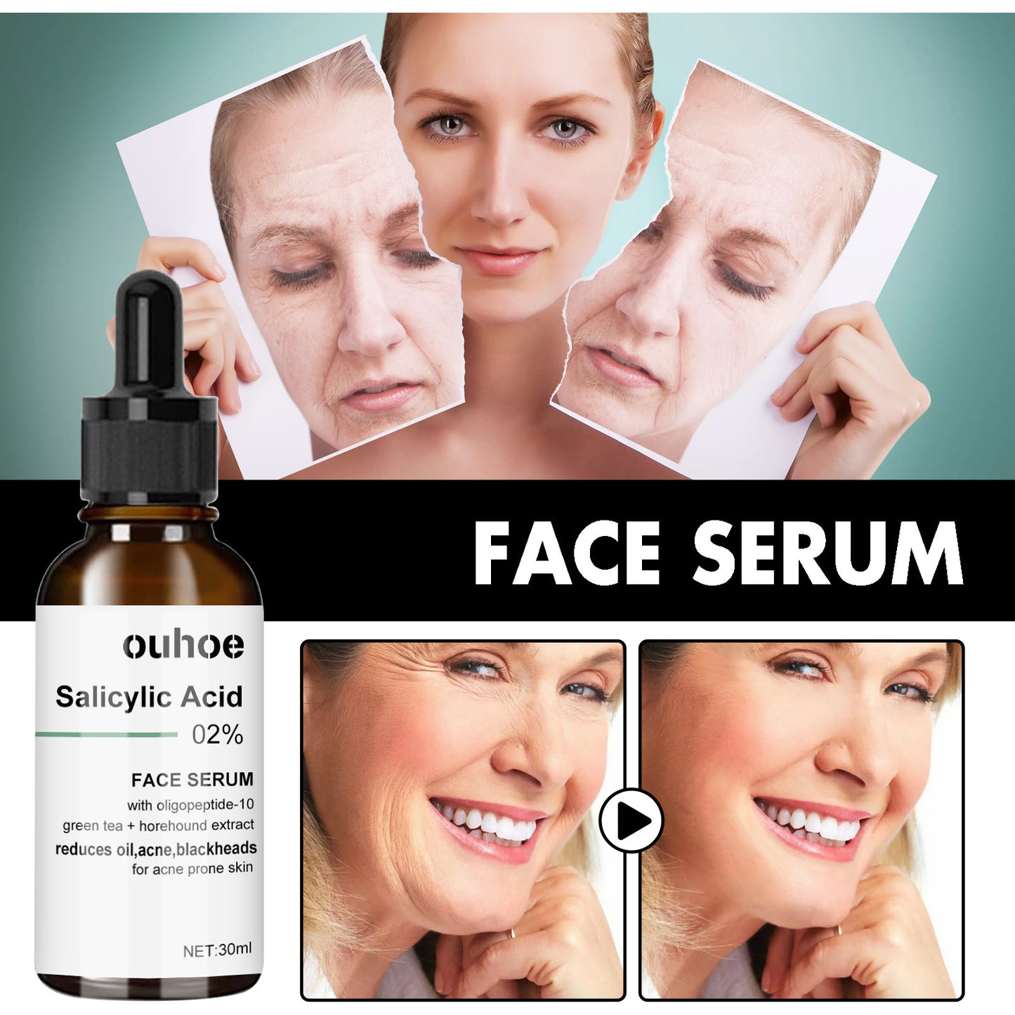 OUHOE anti-aging essence သည် အရေးအကြောင်းများနှင့် နဖူးအရေးအကြောင်းများကို ပျောက်ကင်းစေပြီး အသားအရေကို စိုပြေစေပြီး တင်းရင်းစေခြင်း၊