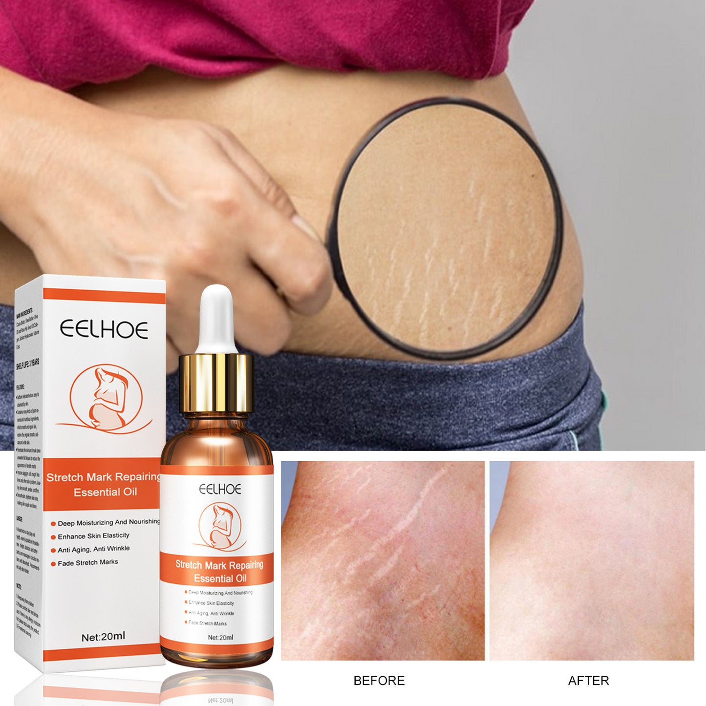 EELHOE Stretch Mark Repair and Removal Essential Oil for Pregnant Women Lifts and Firms Loose Lines and Removes Pregnancy Skin Care Essence