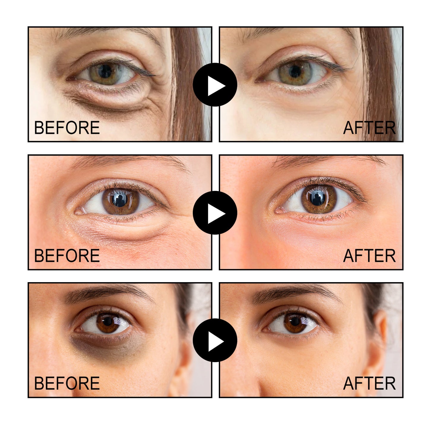OUHOE anti-wrinkle eye cream, hydrating, moisturizing, smoothing and firming skin, smoothing fine lines around the eyes, massage and repairing eye cream
