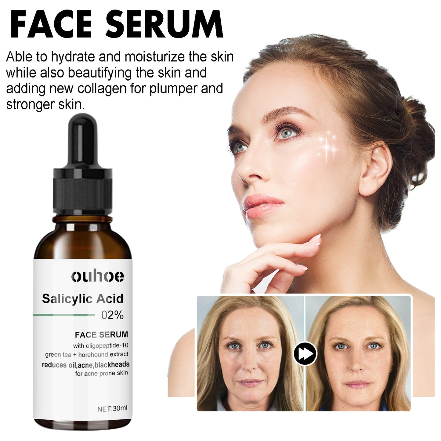 OUHOE anti-aging essence သည် အရေးအကြောင်းများနှင့် နဖူးအရေးအကြောင်းများကို ပျောက်ကင်းစေပြီး အသားအရေကို စိုပြေစေပြီး တင်းရင်းစေခြင်း၊
