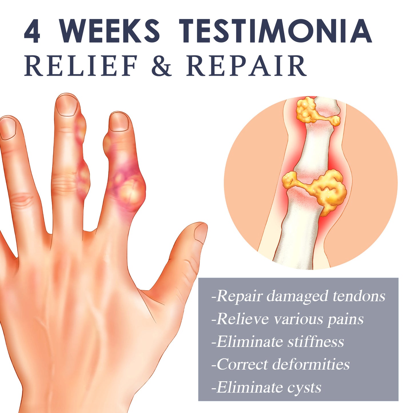 ximonth Bee Venom Joint Cream relieves pain in lumbar spine, hand, foot, joint, shoulder and neck pain massage care cream 