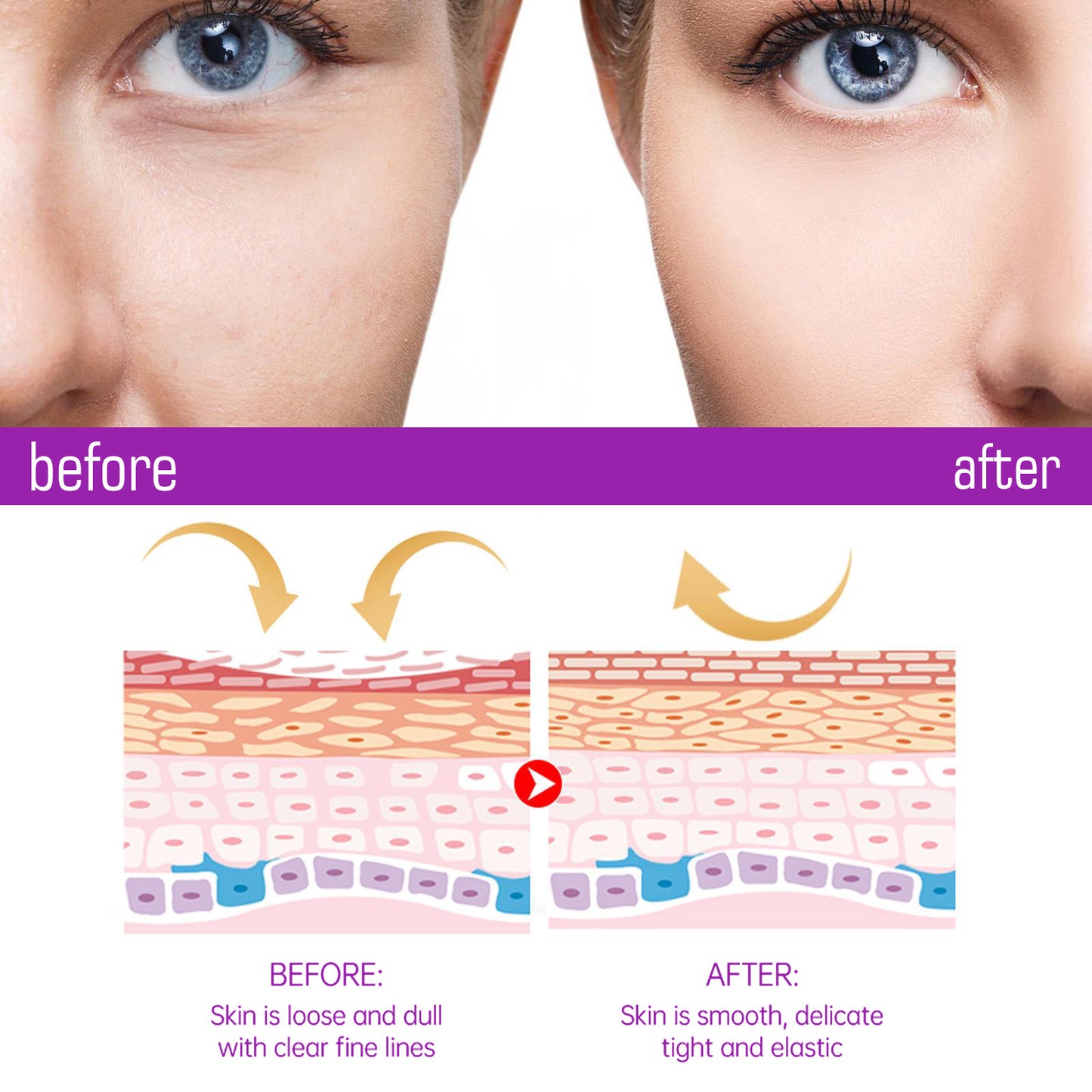 OUHOE anti-aging cream fades nasolabial folds, fine lines around the eyes and neck, firming, anti-wrinkle, and lifts facial skin 