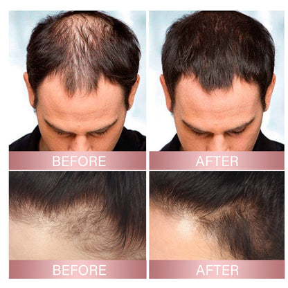 EELHOE Rice Thick Hair Spray Strengthens Hair, Repairs Hair Follicles and Roots, Prevents Hair Loss, Firms Hair, Thick Hair Spray 