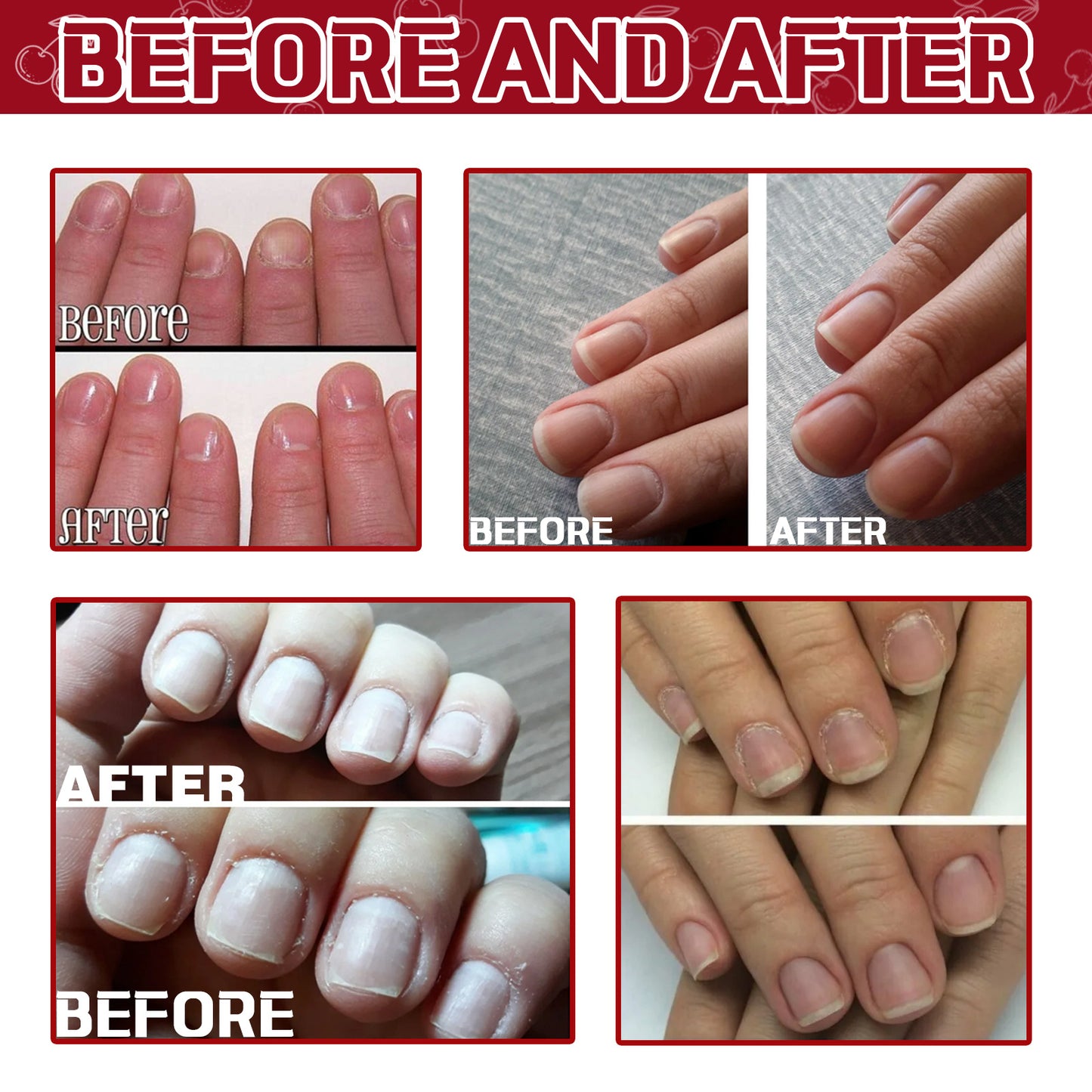OUHOE cuticle oil strengthens nail cuticles, removes cuticles, moisturizes and nourishes nail edge armor oil 