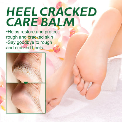 OUHOE Cracked Heel Care Cream Repairs Heel Peeling, Prevents Dry and Cracked Feet, Moisturizing Care Cream 