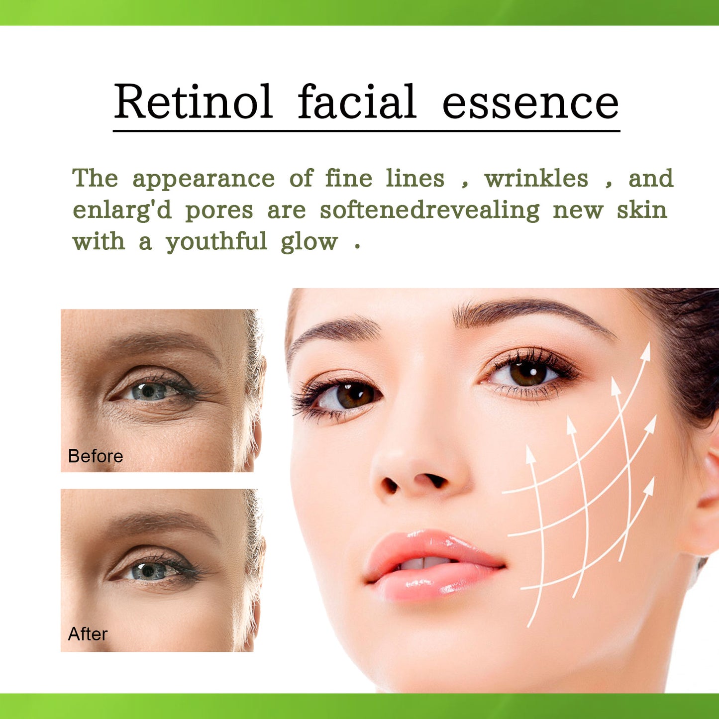 OUHOE Retinol Essence fades nasolabial folds, fine lines around eyes, facial anti-wrinkle, firming, brightening and smoothing skin.