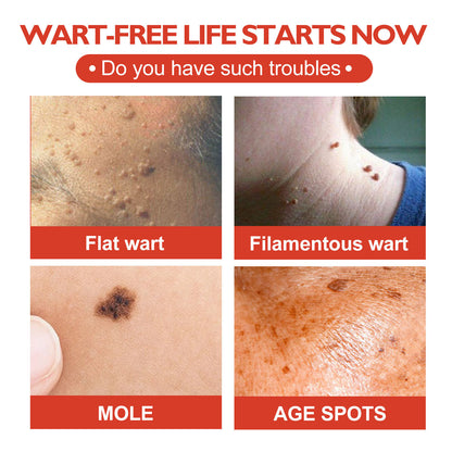 OUHOE Acne Patch Skin Clearing Pimples ဝက်ခြံ အမည်းရောင် မှဲ့များ ပြုပြင်ခြင်း အရေပြား အမှတ်များ ကြွက်နို့ ပြောင်းဖူး အစက်အပြောက် Patch 
