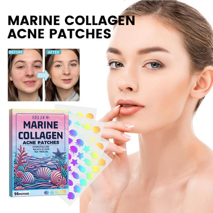 EELHOE Cute Colorful Acne Patch Cleansing Facial Acne Pimples Multi-Shape Portable Acne Patch 