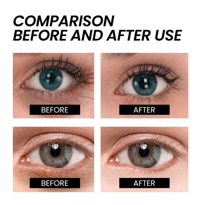 West&amp;Month Firming Eye Cream reduces fine lines, eye bags, dark circles, nasolabial folds, crow's feet, and moisturizes eye skin 
