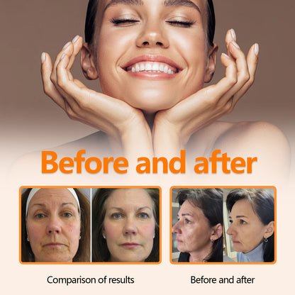 OUHOE ဗီတာမင် C Facial Essence သည် ညီညာသော အရေးကြောင်းများကို ပျောက်ကင်းစေပြီး မျက်နှာအသားရေကို တင်းရင်းစေကာ အိုမင်းရင့်ရော်မှုကို ဆန့်ကျင်ပေးသည် ။ 