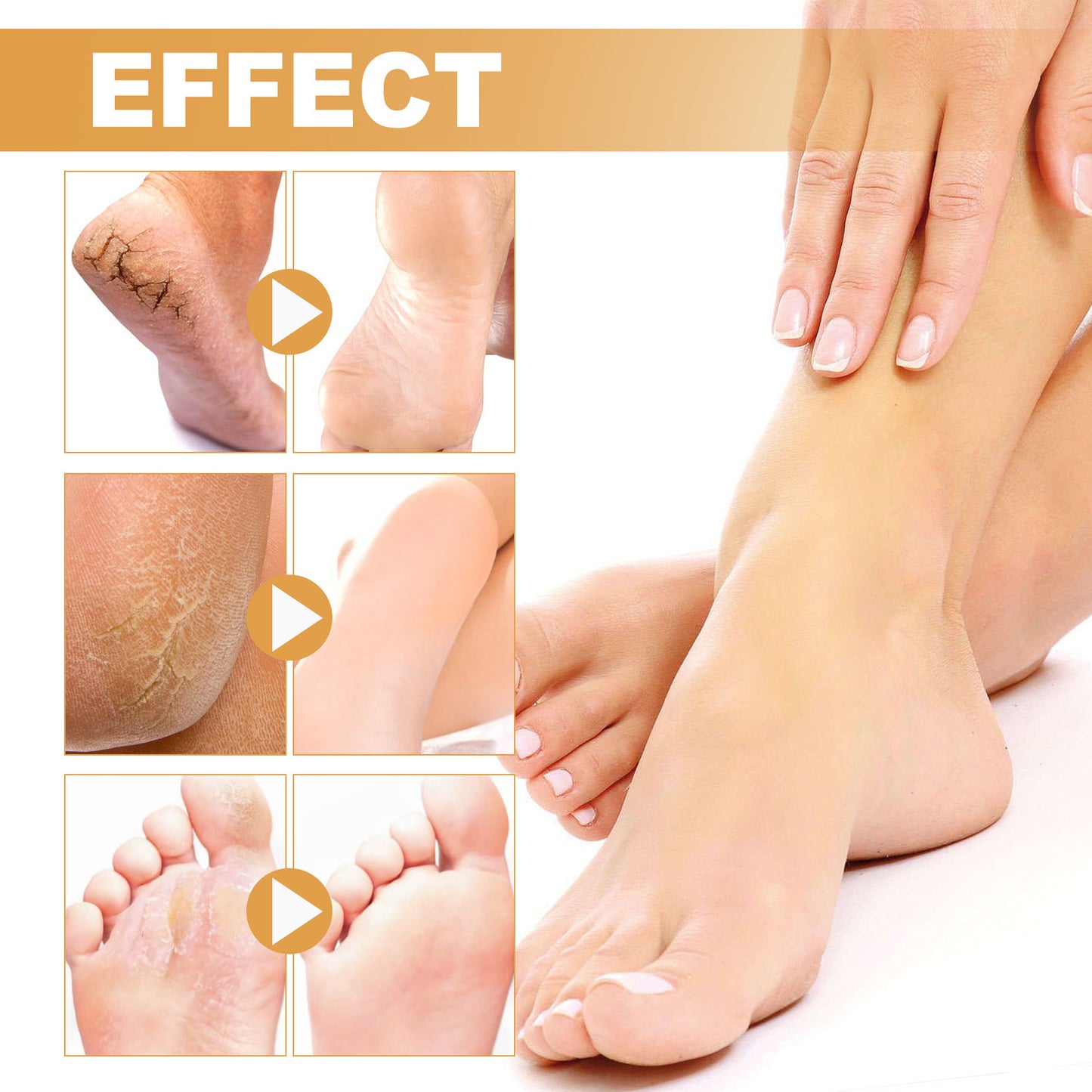 OUHOE foot spray သည် cuticles ၊ calluses နှင့် dead skin များကို သန့်စင်ပေးသည်၊ ခြောက်သွေ့ခြင်းနှင့် အက်ကွဲကြောင်းများကို ကာကွယ်ပေးသည်၊ ကြမ်းတမ်းသော အသားအရေကို ပြန်လည်ပြုပြင်ပေးသည်၊ moisturize နှင့် spray ကို ဂရုစိုက်ပေးသည် ။ 