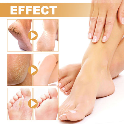 OUHOE foot spray သည် cuticles ၊ calluses နှင့် dead skin များကို သန့်စင်ပေးသည်၊ ခြောက်သွေ့ခြင်းနှင့် အက်ကွဲကြောင်းများကို ကာကွယ်ပေးသည်၊ ကြမ်းတမ်းသော အသားအရေကို ပြန်လည်ပြုပြင်ပေးသည်၊ moisturize နှင့် spray ကို ဂရုစိုက်ပေးသည် ။ 
