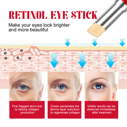 OUHOE Retinol Wrinkle Lightening Eye Cream Firms and Lightens Fine Lines Dark Circles Eye Circle Brightening Double Eyes Eye Cream 
