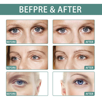 EELHOE Anti-Aging Eye Series မှ Deep Moisturizing Smoothing Eye Bags Care Anti-aging Eye Cream Series မျက်လုံးတစ်ဝိုက် 