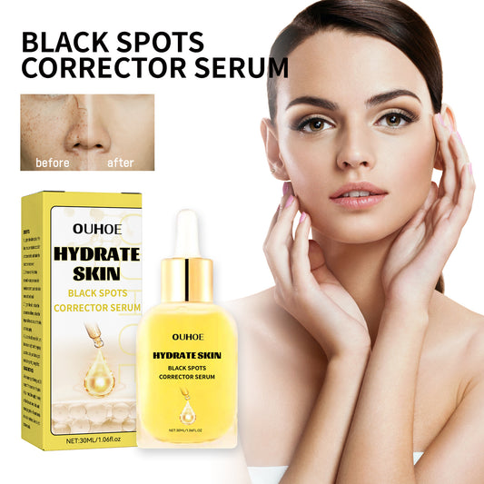 OUHOE black spot correction essence သည် မျက်နှာအစက်အပြောက်များကို ပျောက်ကင်းစေပြီး အသားအရေကို စိုပြေစေပြီး နုပျိုတောက်ပစေကာ whitening essence ၊