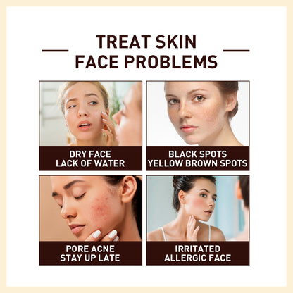 OUHOE Rice Anti-Wrinkle Essence Firming Facial Skin Anti-Aging Repair Fading Spots and Wrinkles Skin Care Solution 