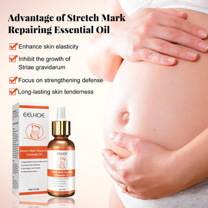 EELHOE Stretch Mark Repair and Removal Essential Oil for Pregnant Women Lifts and Firms Loose Lines and Removes Pregnancy Skin Care Essence 