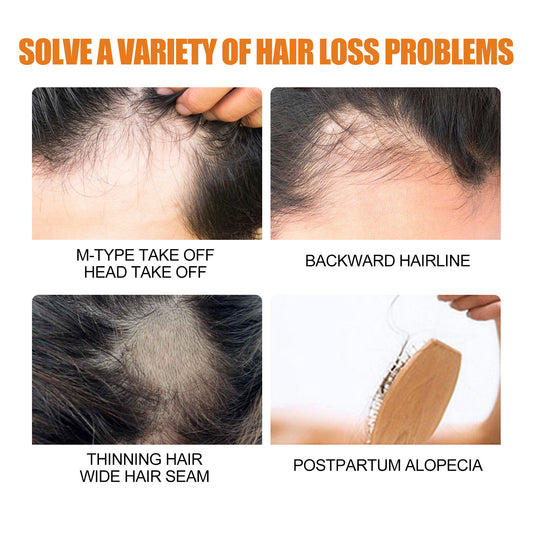 Jaysuing hair growth spray men's hair and beard thickening care solution strengthens hair and prevents hair loss 
