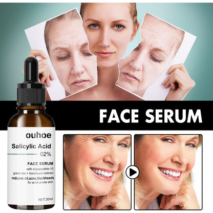 OUHOE anti-aging essence သည် အရေးအကြောင်းများနှင့် နဖူးအရေးအကြောင်းများကို ပျောက်ကင်းစေပြီး အသားအရေကို စိုပြေစေပြီး တင်းရင်းစေခြင်း၊ 