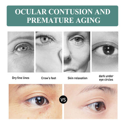 EELHOE Anti-Aging Eye Series မှ Deep Moisturizing Smoothing Eye Bags Care Anti-aging Eye Cream Series မျက်လုံးတစ်ဝိုက် 