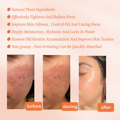 OUHOE Pore Repair Essence delicately brightens skin tone, shrinks pores, hydrates, moisturizes, and tightens skin. 
